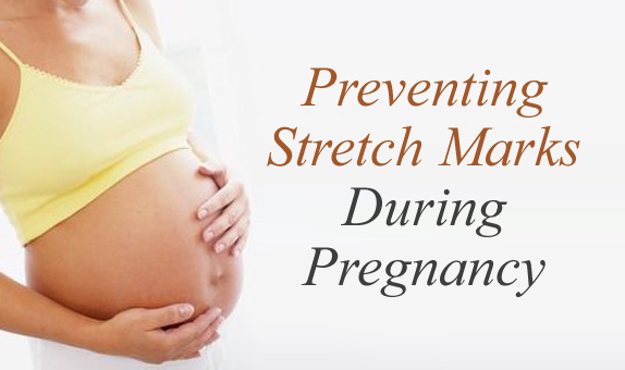 pregnancy and stretch marks